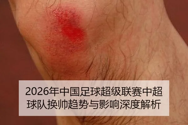 2026年中国足球超级联赛中超球队换帅趋势与影响深度解析